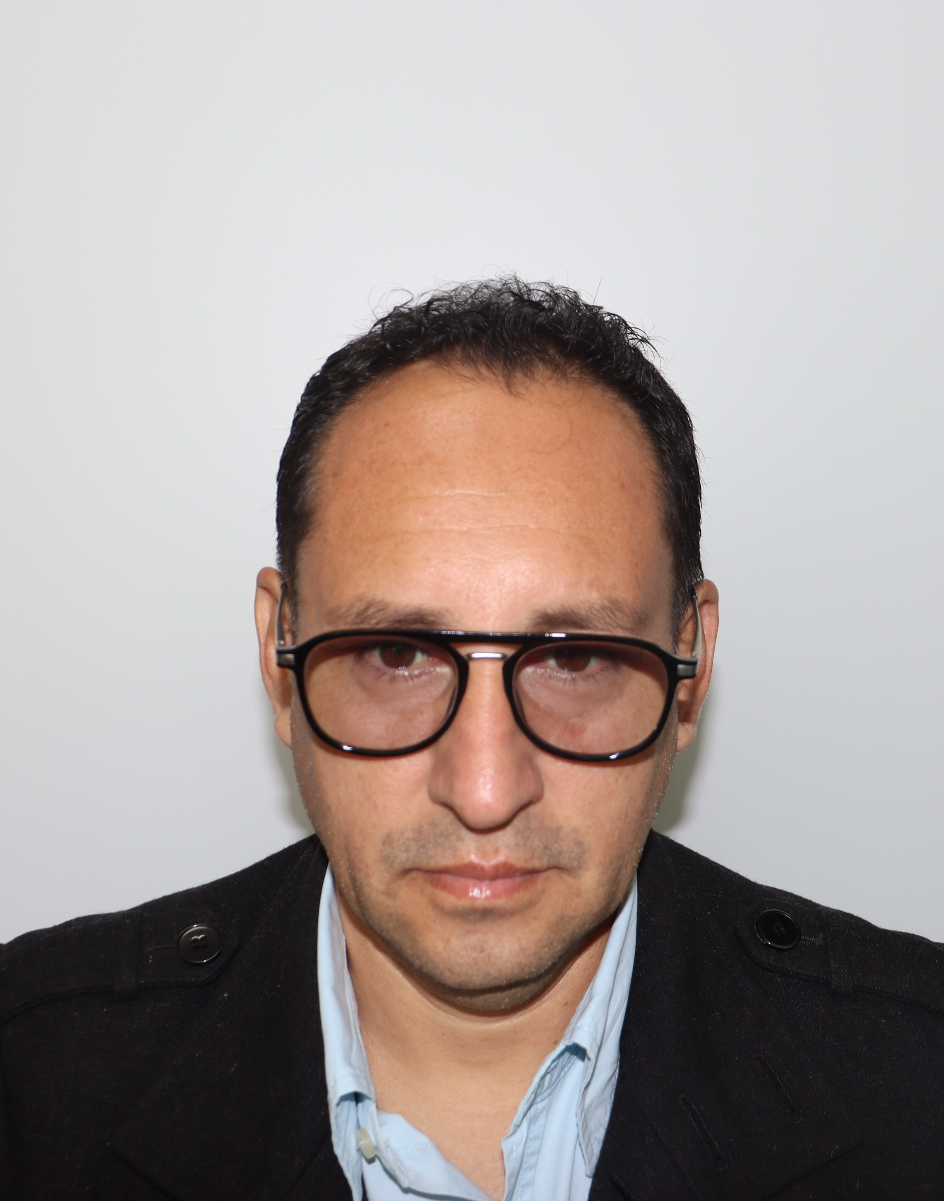 Antes del tratamiento - Caso 3