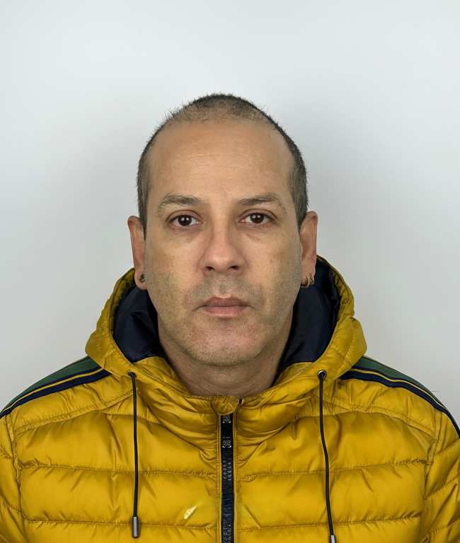 Antes del tratamiento - Caso 1